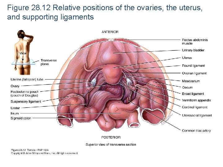 Figure 28. 12 Relative positions of the ovaries, the uterus, and supporting ligaments 