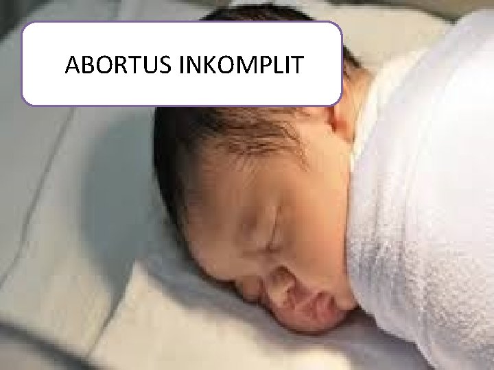  ABORTUS INKOMPLIT 