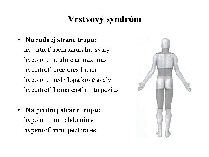 Vrstvový syndróm • Na zadnej strane trupu: hypertrof. ischiokrurálne svaly hypoton. m. gluteus maximus