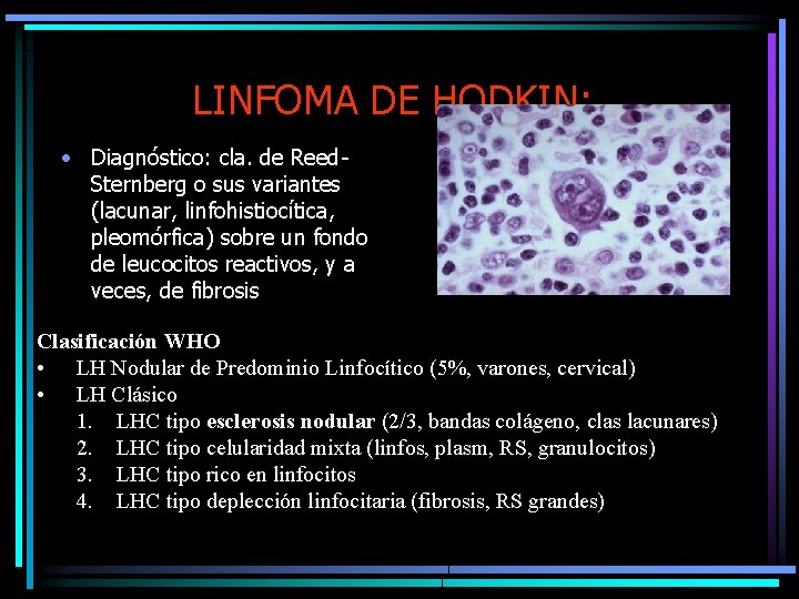 LINFOMA DE HODKIN: • Diagnóstico: cla. de Reed. Sternberg o sus variantes (lacunar, linfohistiocítica,