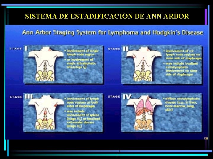 SISTEMA DE ESTADIFICACIÓN DE ANN ARBOR 