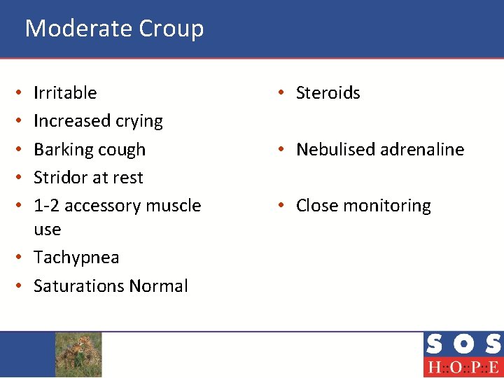 Moderate Croup Irritable Increased crying Barking cough Stridor at rest 1 -2 accessory muscle