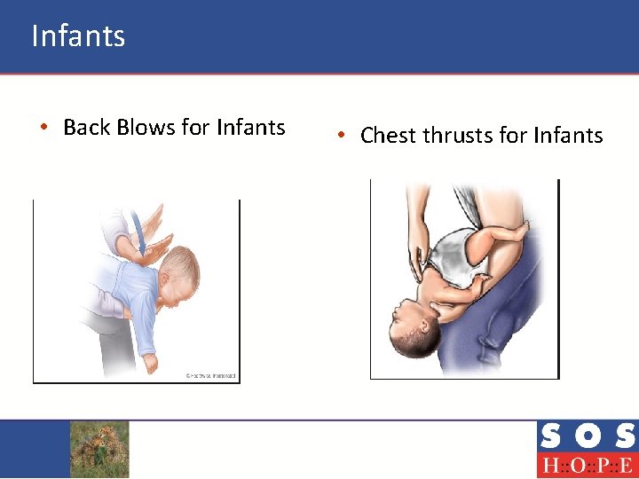 Infants • Back Blows for Infants • Chest thrusts for Infants 