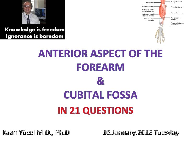 ANTERIOR ASPECT OF THE FOREARM & CUBITAL FOSSA IN 21 QUESTIONS Kaan Yücel M.