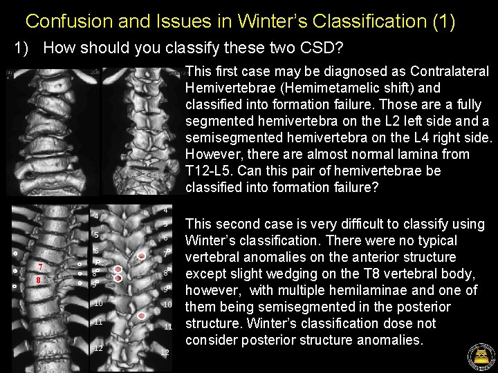 Confusion and Issues in Winter’s Classification (1) 1) How should you classify these two Confusion and Issues in Winter’s Classification (1) 1) How should you classify these two