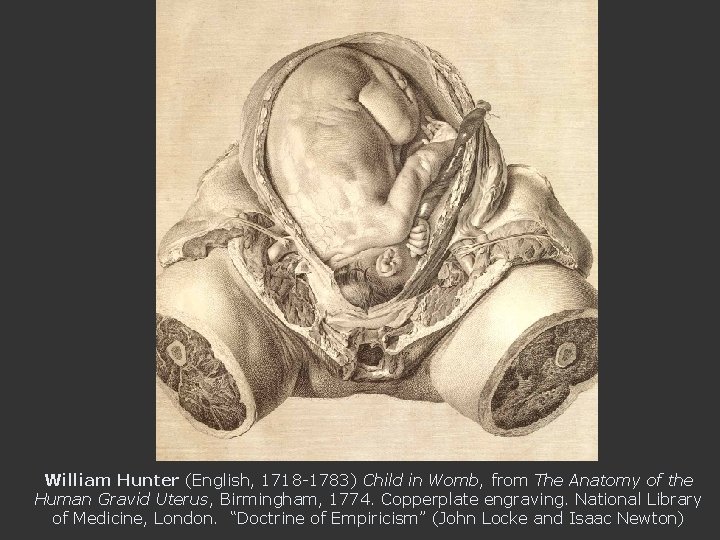William Hunter (English, 1718 -1783) Child in Womb, from The Anatomy of the Human