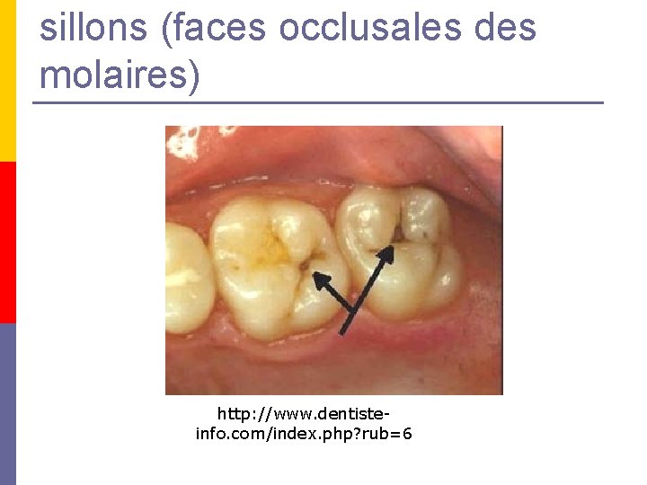 sillons (faces occlusales des molaires) http: //www. dentisteinfo. com/index. php? rub=6 sillons (faces occlusales des molaires) http: //www. dentisteinfo. com/index. php? rub=6