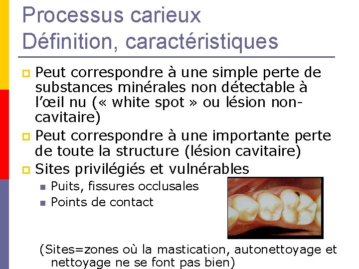 Processus carieux Définition, caractéristiques Peut correspondre à une simple perte de substances minérales non Processus carieux Définition, caractéristiques Peut correspondre à une simple perte de substances minérales non