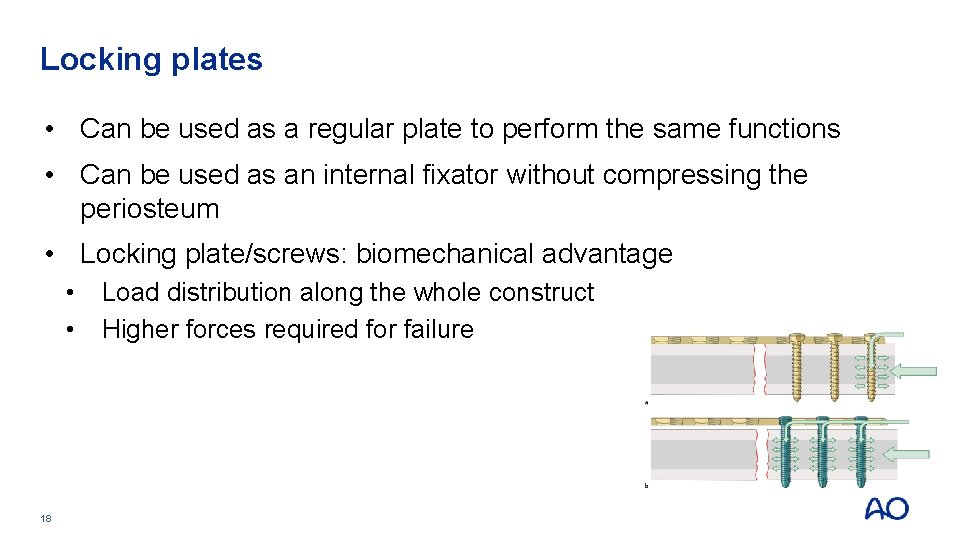 Locking plates • Can be used as a regular plate to perform the same Locking plates • Can be used as a regular plate to perform the same