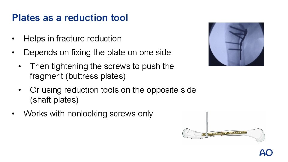 Plates as a reduction tool • Helps in fracture reduction • Depends on fixing Plates as a reduction tool • Helps in fracture reduction • Depends on fixing