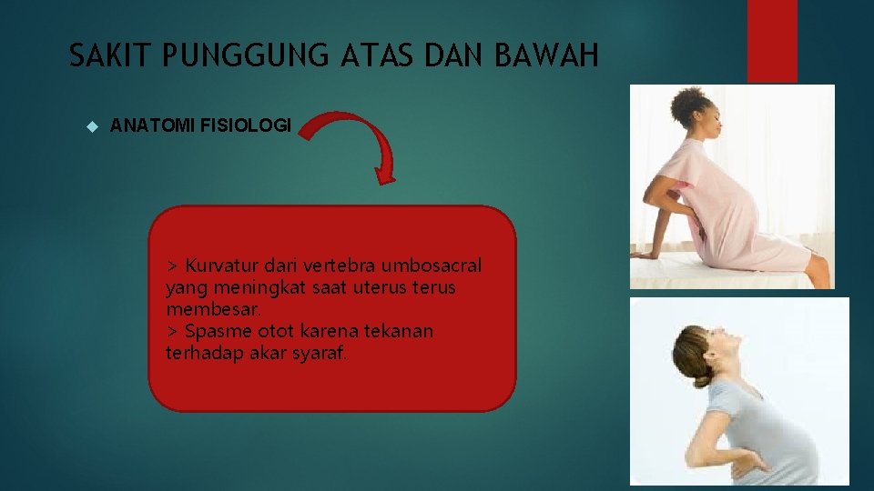 SAKIT PUNGGUNG ATAS DAN BAWAH ANATOMI FISIOLOGI > Kurvatur dari vertebra umbosacral yang meningkat
