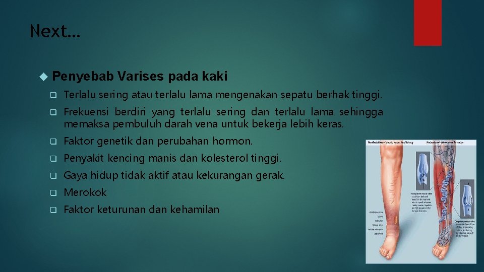 Next… Penyebab Varises pada kaki q Terlalu sering atau terlalu lama mengenakan sepatu berhak