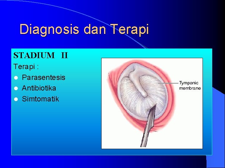 Diagnosis dan Terapi STADIUM II Terapi : l Parasentesis l Antibiotika l Simtomatik 