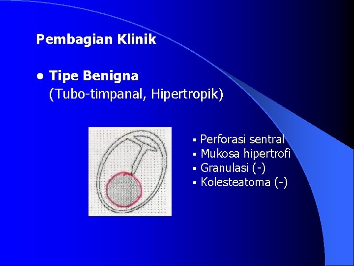 Pembagian Klinik l Tipe Benigna (Tubo-timpanal, Hipertropik) § § Perforasi sentral Mukosa hipertrofi Granulasi