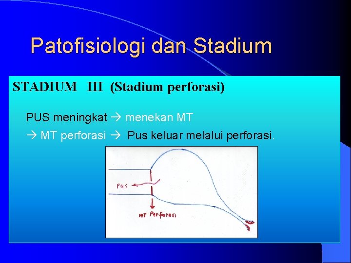 Patofisiologi dan Stadium STADIUM III (Stadium perforasi) PUS meningkat menekan MT perforasi Pus keluar