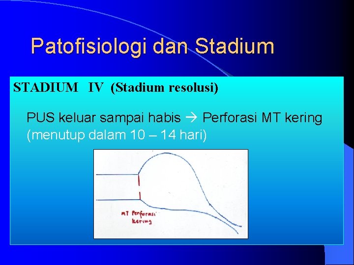 Patofisiologi dan Stadium STADIUM IV (Stadium resolusi) PUS keluar sampai habis Perforasi MT kering