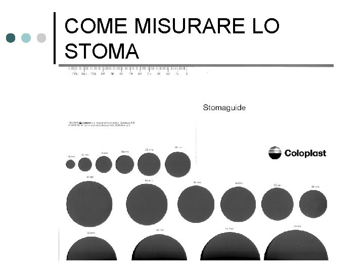 COME MISURARE LO STOMA 