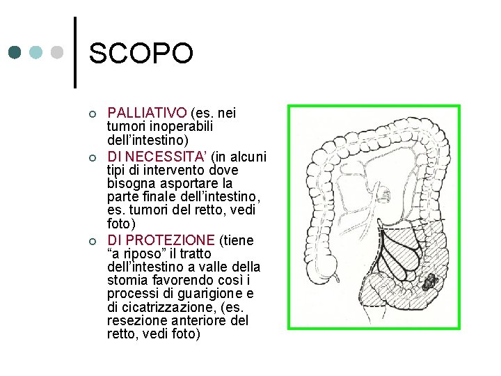 SCOPO ¢ ¢ ¢ PALLIATIVO (es. nei tumori inoperabili dell’intestino) DI NECESSITA’ (in alcuni