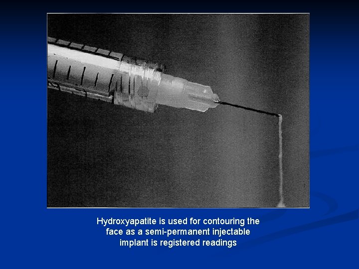 Hydroxyapatite is used for contouring the face as a semi-permanent injectable implant is registered