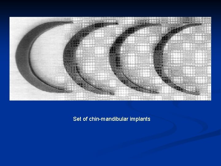 Set of chin-mandibular implants 