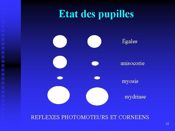 Etat des pupilles Égales anisocorie myosis mydriase REFLEXES PHOTOMOTEURS ET CORNEENS 18 