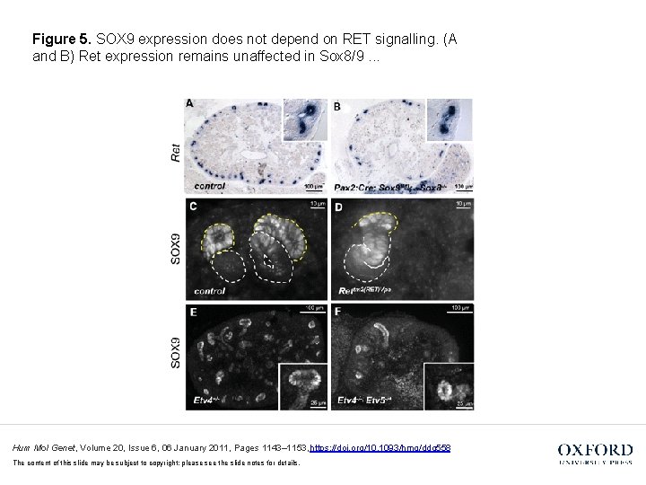Figure 5. SOX 9 expression does not depend on RET signalling. (A and B)