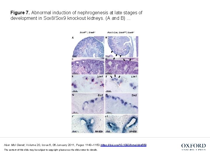 Figure 7. Abnormal induction of nephrogenesis at late stages of development in Sox 8/Sox