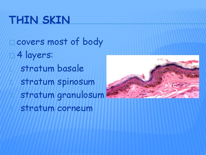 THIN SKIN � covers most of body � 4 layers: 1. stratum basale 2.