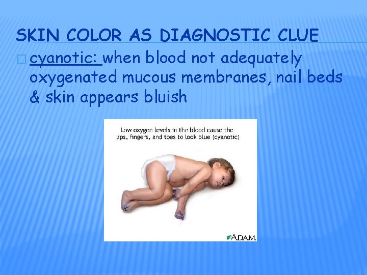 SKIN COLOR AS DIAGNOSTIC CLUE � cyanotic: when blood not adequately oxygenated mucous membranes,