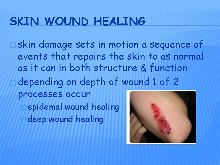 SKIN WOUND HEALING � skin damage sets in motion a sequence of events that