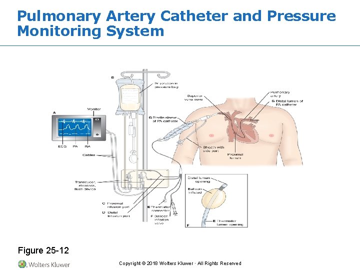Pulmonary Artery Catheter and Pressure Monitoring System Figure 25 -12 Copyright © 2018 Wolters