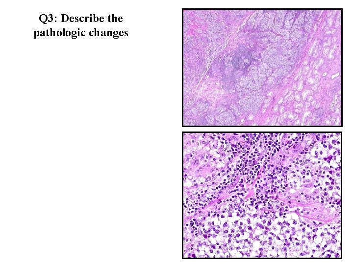 Q 3: Describe the pathologic changes 