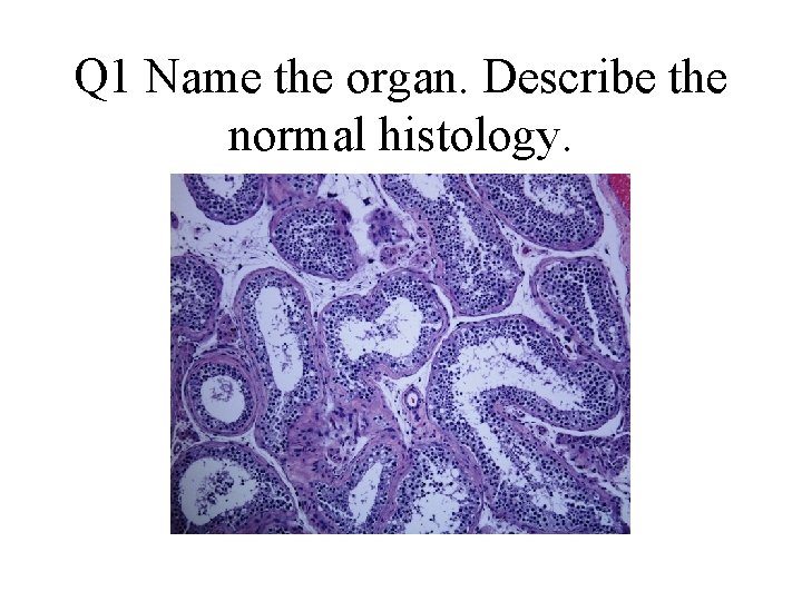 Q 1 Name the organ. Describe the normal histology. 