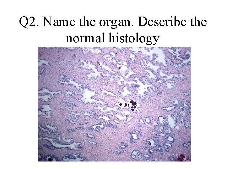 Q 2. Name the organ. Describe the normal histology Q 2. Name the organ. Describe the normal histology