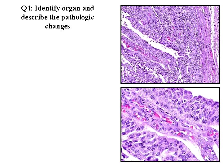 Q 4: Identify organ and describe the pathologic changes 