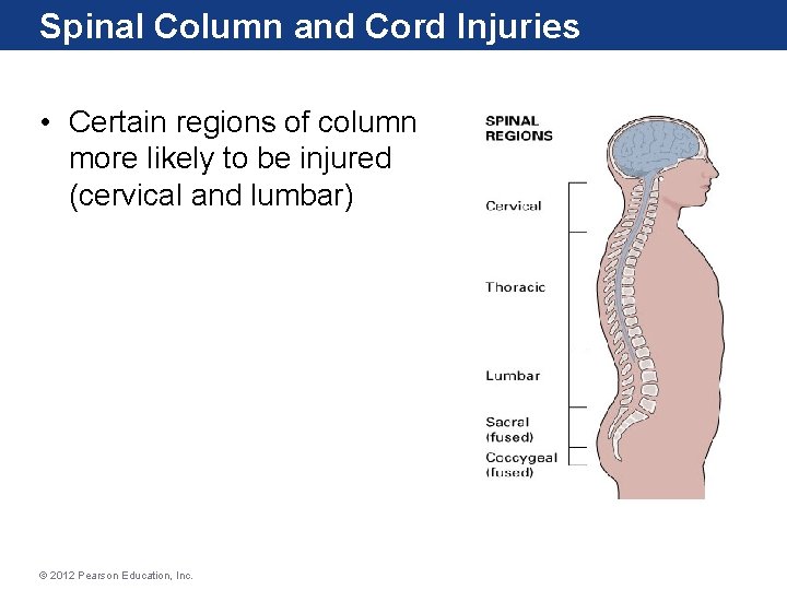 Spinal Column and Cord Injuries • Certain regions of column more likely to be