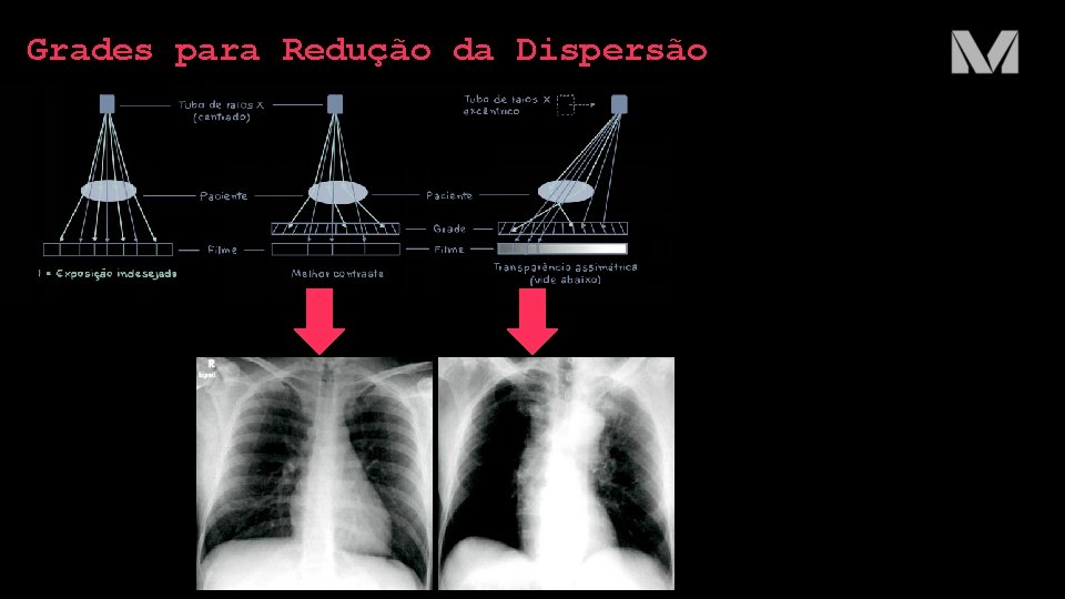 Grades para Redução da Dispersão 