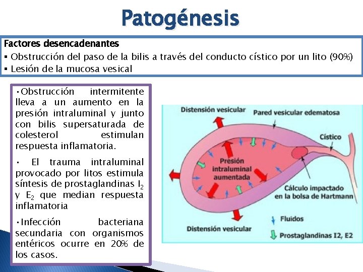 Patogénesis Factores desencadenantes § Obstrucción del paso de la bilis a través del conducto