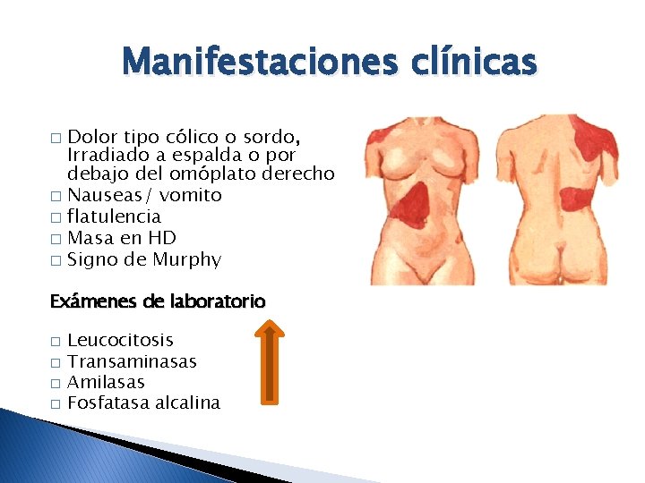 Manifestaciones clínicas Dolor tipo cólico o sordo, Irradiado a espalda o por debajo del