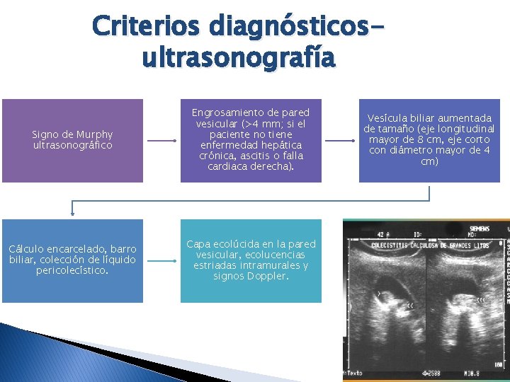 Criterios diagnósticosultrasonografía Signo de Murphy ultrasonográfico Engrosamiento de pared vesicular (>4 mm; si el