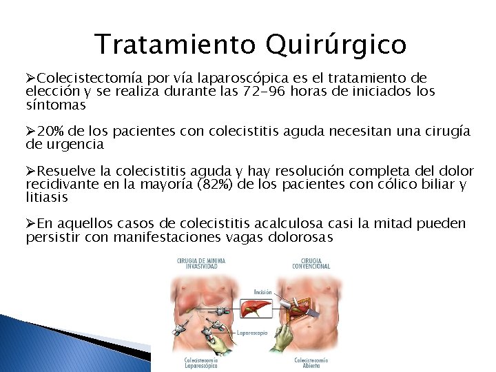 Tratamiento Quirúrgico ØColecistectomía por vía laparoscópica es el tratamiento de elección y se realiza