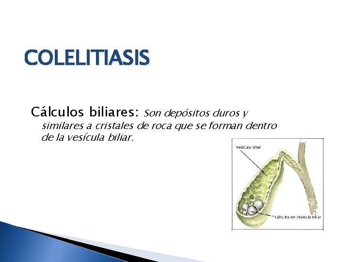 COLELITIASIS Cálculos biliares: Son depósitos duros y similares a cristales de roca que se