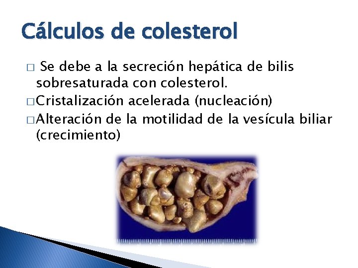 Cálculos de colesterol Se debe a la secreción hepática de bilis sobresaturada con colesterol.