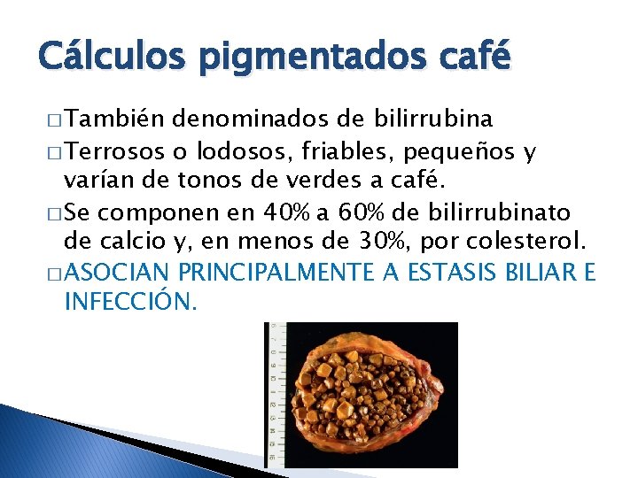 Cálculos pigmentados café � También denominados de bilirrubina � Terrosos o lodosos, friables, pequeños