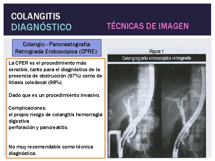 COLANGITIS DIAGNÓSTICO Colangio - Pancreatografía Retrograda Endoscópica (CPRE): La CPER es el procedimiento más