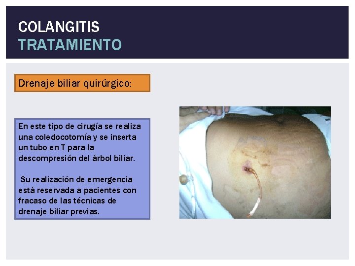 COLANGITIS TRATAMIENTO Drenaje biliar quirúrgico: En este tipo de cirugía se realiza una coledocotomía