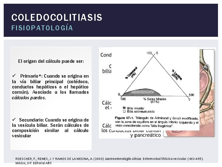 COLEDOCOLITIASIS FISIOPATOLOGÍA El origen del cálculo puede ser: ü Primario*: Cuando se origina en