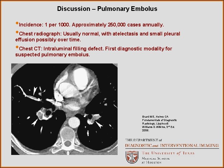 Discussion – Pulmonary Embolus • Incidence: 1 per 1000. Approximately 250, 000 cases annually.