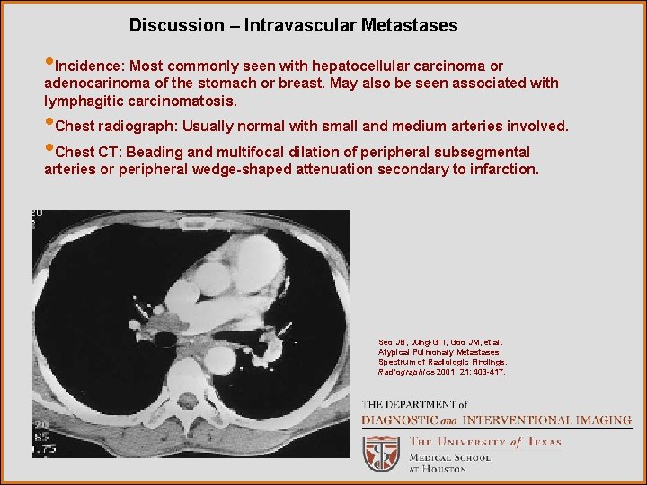 Discussion – Intravascular Metastases • Incidence: Most commonly seen with hepatocellular carcinoma or adenocarinoma