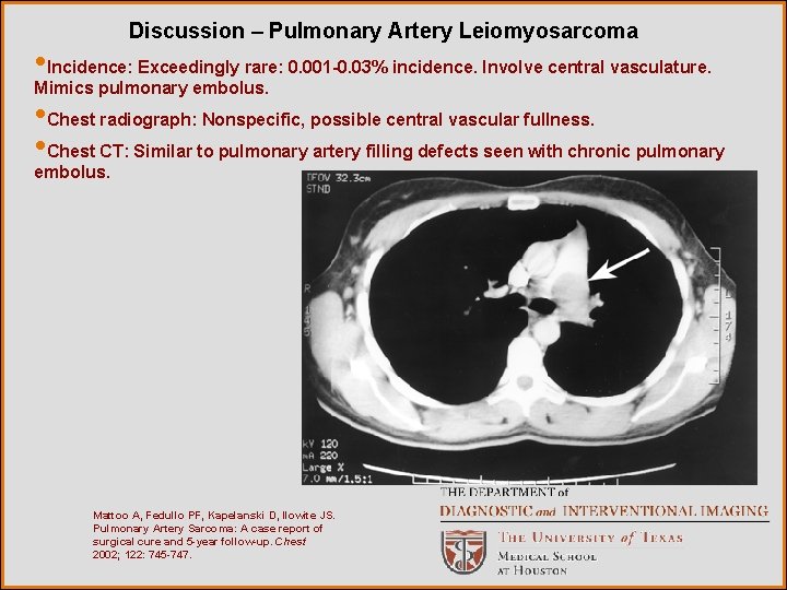 Discussion – Pulmonary Artery Leiomyosarcoma • Incidence: Exceedingly rare: 0. 001 -0. 03% incidence.
